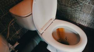 Cara cepat dan mudah membersihkan toilet dari karat dan plak kuning?